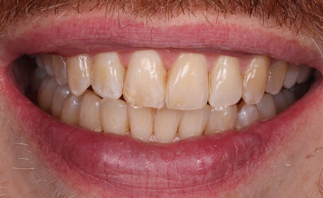 395_before_img